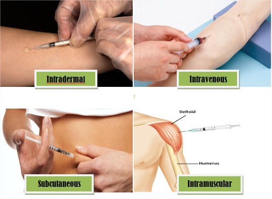 intradermal injection sites